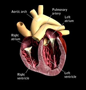 Canine Pericardial Disease -heart disease in dogs