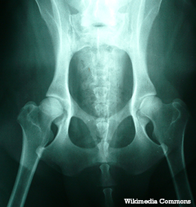 Hip Dysplasia in Dogs | Symptoms and 