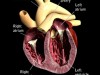 pericardial disease dogs