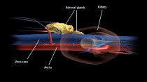 addisons disease in dogs