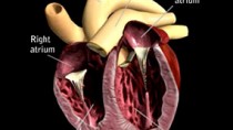 pericardial disease dogs