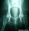 Canine Hip Dysplasia: An Overview